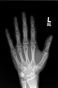 Background cover of The Bit of Human Left